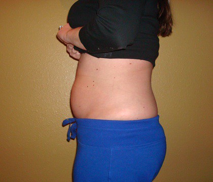 12 Weeks Pregnant Belly Pics