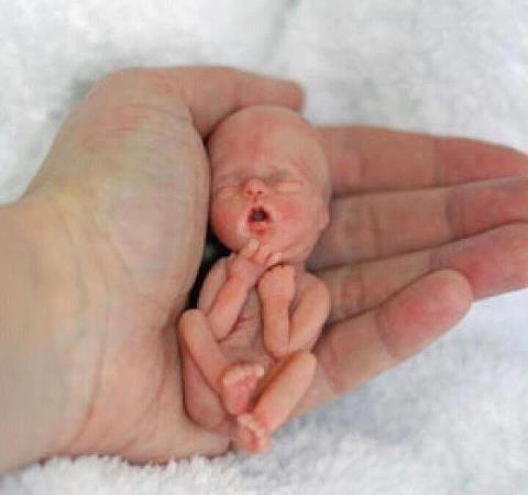 12 Weeks Pregnant Fetus Abortion