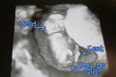 12 Weeks Pregnant Ultrasound Gender Pictures