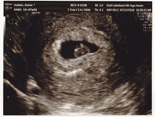 12 Weeks Pregnant Ultrasound Gender Pictures