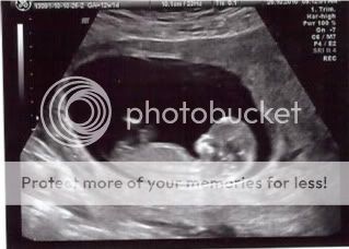 12 Weeks Pregnant Ultrasound Girl