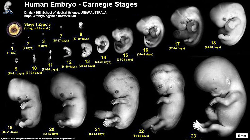 16 Weeks Pregnant Pictures Ultrasound