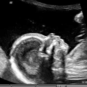 16 Weeks Pregnant Pictures Ultrasound