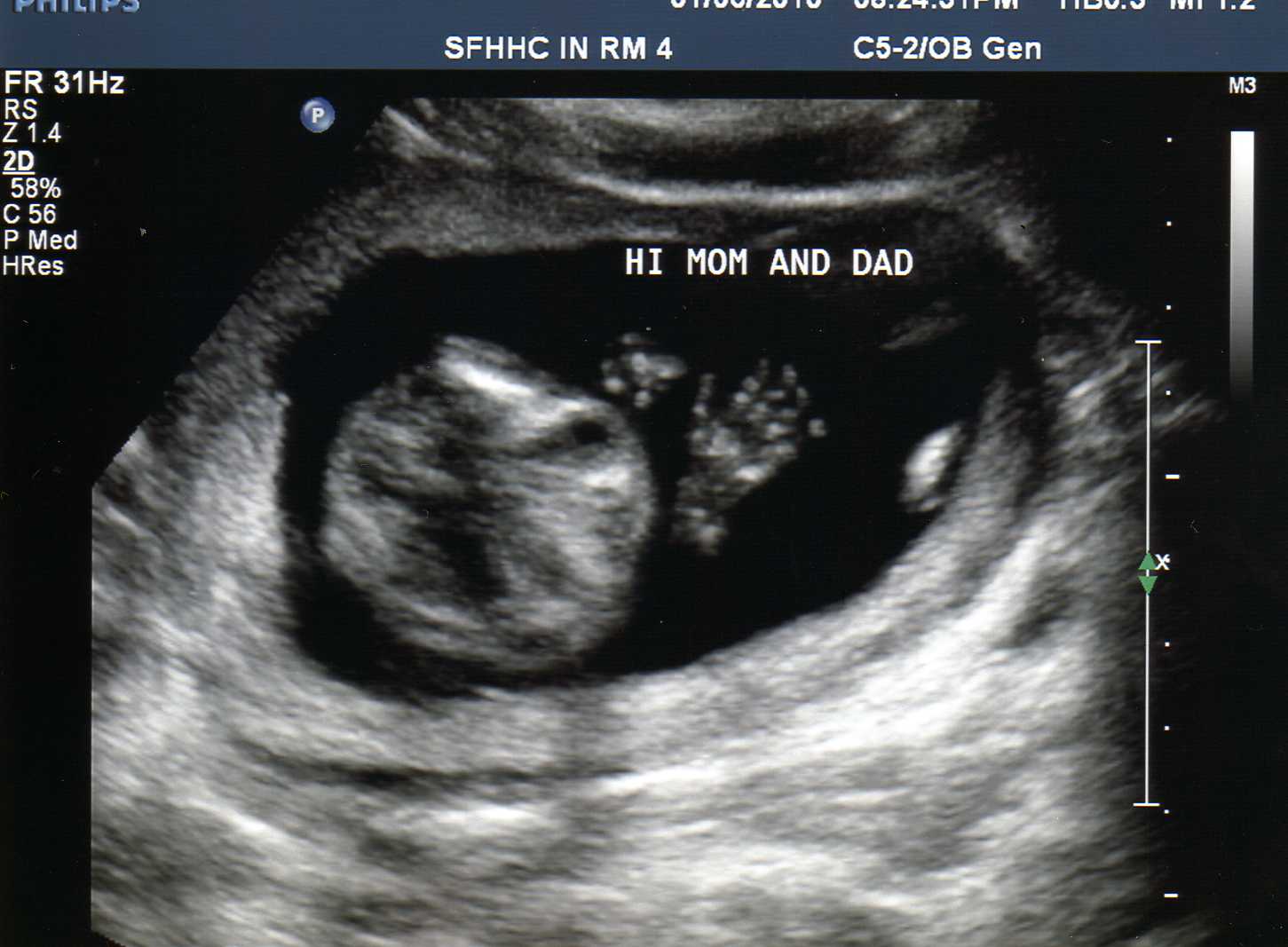 16 Weeks Pregnant Pictures Ultrasound