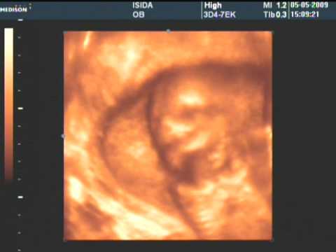 16 Weeks Pregnant Pictures Ultrasound