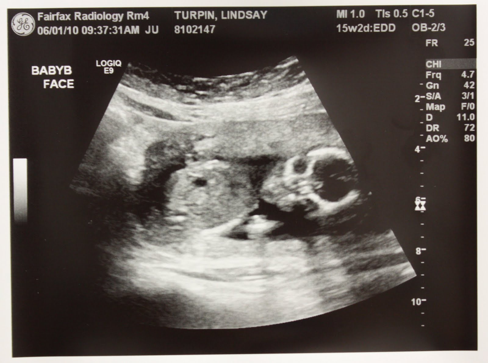 16 Weeks Pregnant Ultrasound