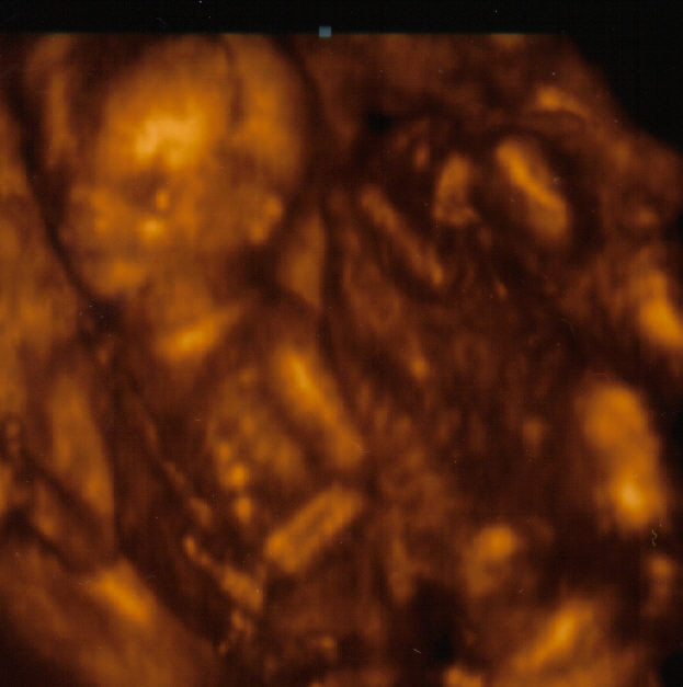 16 Weeks Pregnant Ultrasound