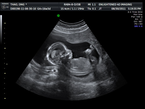 16 Weeks Pregnant Ultrasound