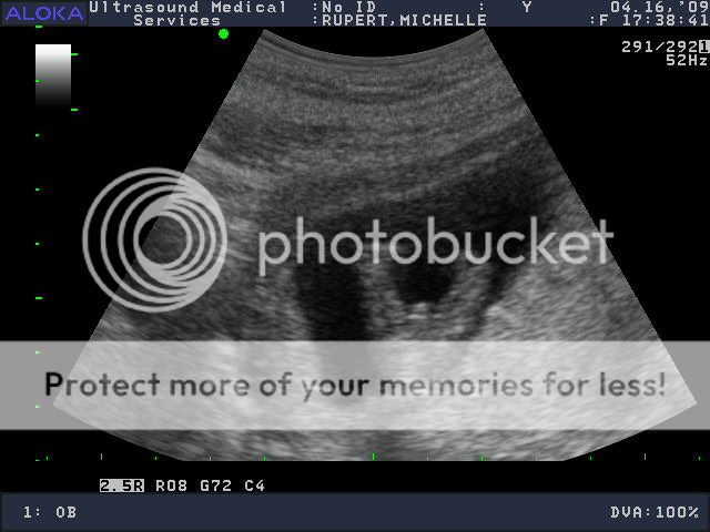 16 Weeks Pregnant Ultrasound