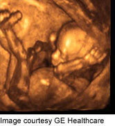 16 Weeks Pregnant Ultrasound