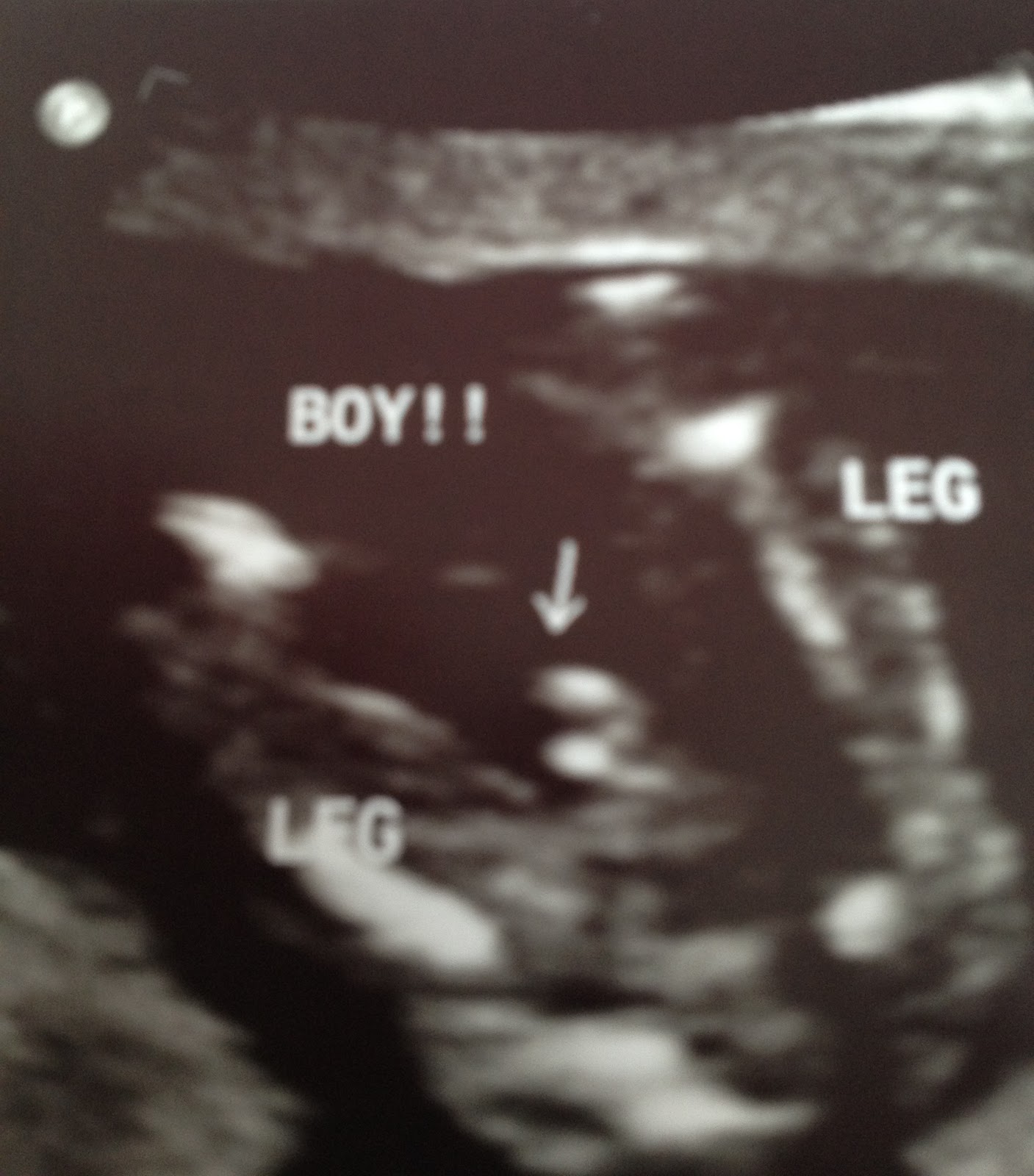 16 Weeks Pregnant Ultrasound