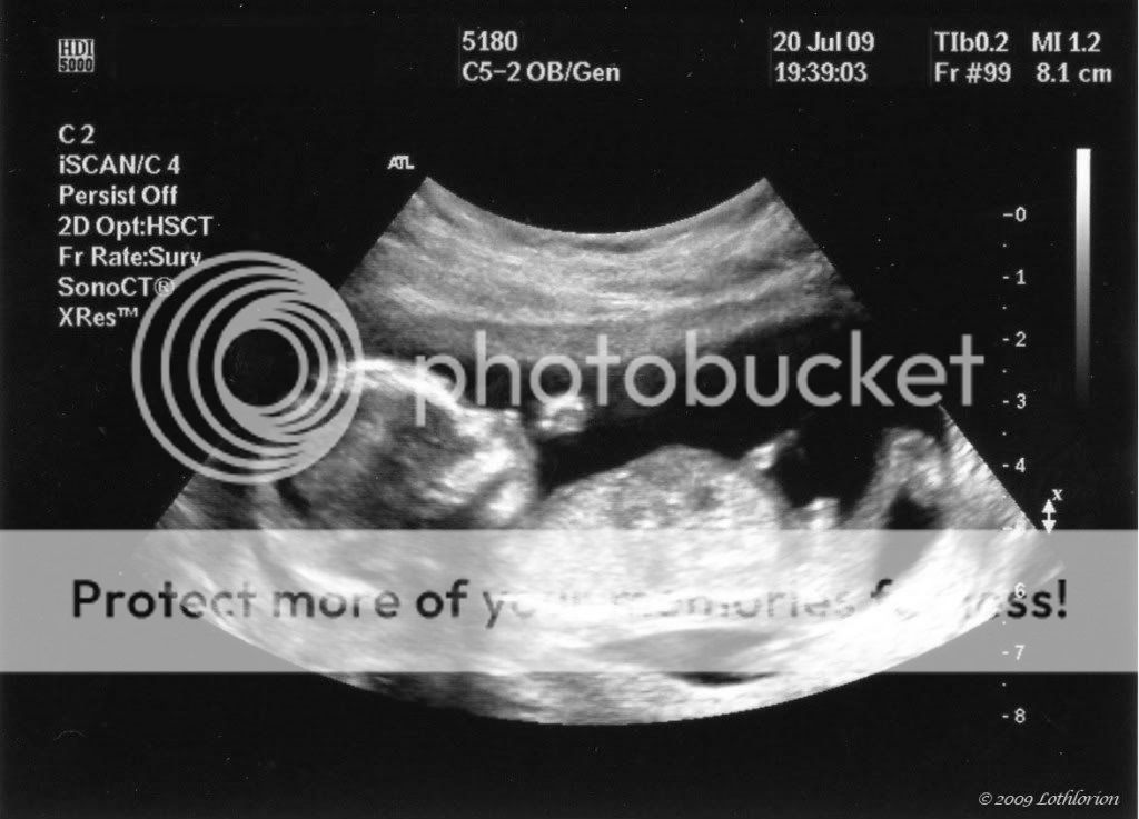 16 Weeks Pregnant Ultrasound