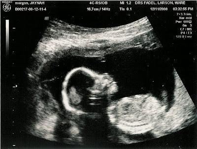 16 Weeks Pregnant Ultrasound