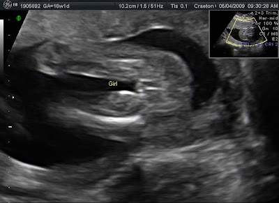 16 Weeks Pregnant Ultrasound Girl