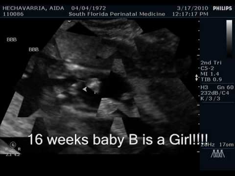 16 Weeks Pregnant With Twins Ultrasound