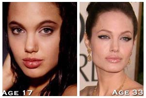 Angelina Jolie Lips Before Surgery