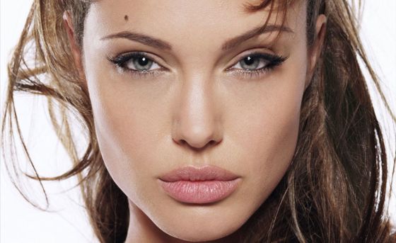 Angelina Jolie Lips Surgery