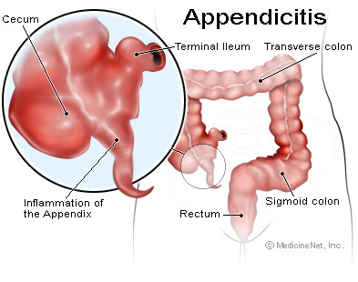 Appendix