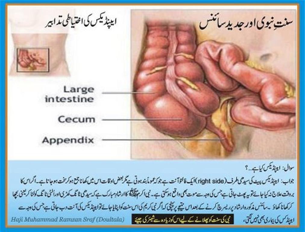 Appendix