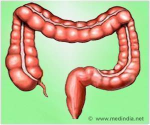 Appendix Operation Cost In Chennai