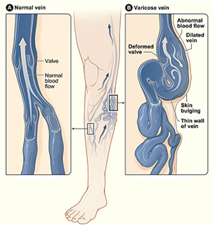 Appendix Operation Cost In Chennai