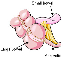 Appendix Operation Cost In Delhi