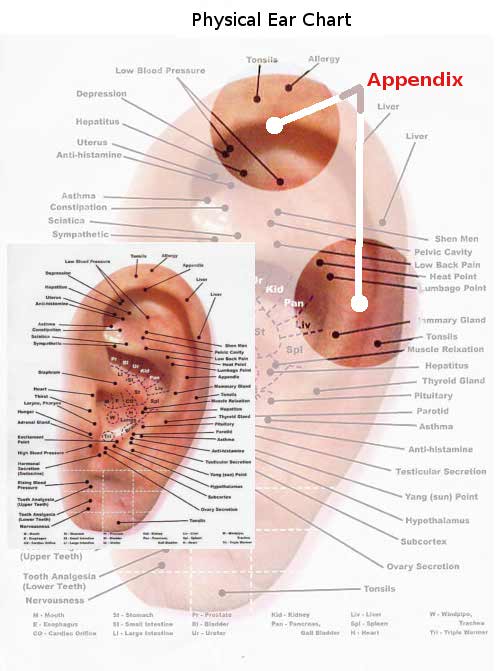 Appendix Pain