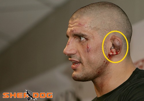 Bj Penn Ears