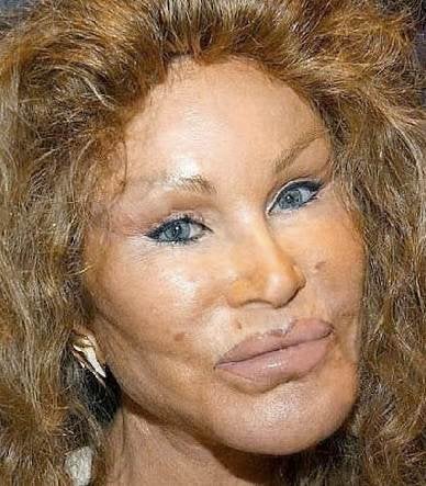 Catwoman Plastic Surgery Before