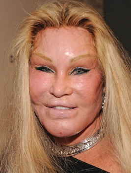 Catwoman Plastic Surgery Gone Wrong