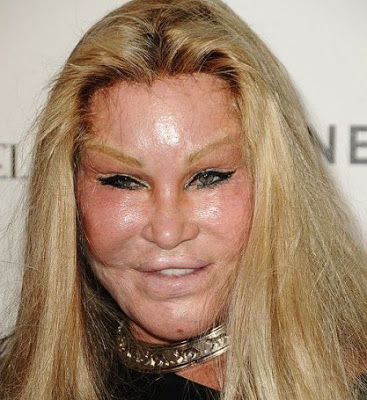 Catwoman Plastic Surgery Gone Wrong