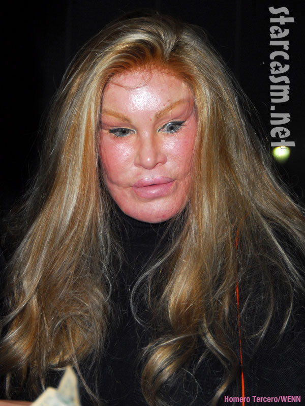 Catwoman Plastic Surgery Gone Wrong