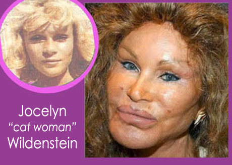 Catwoman Plastic Surgery Images