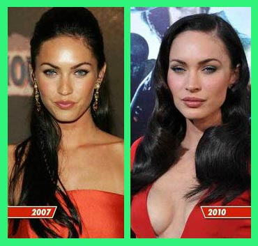 Catwoman Plastic Surgery Lady Before And After