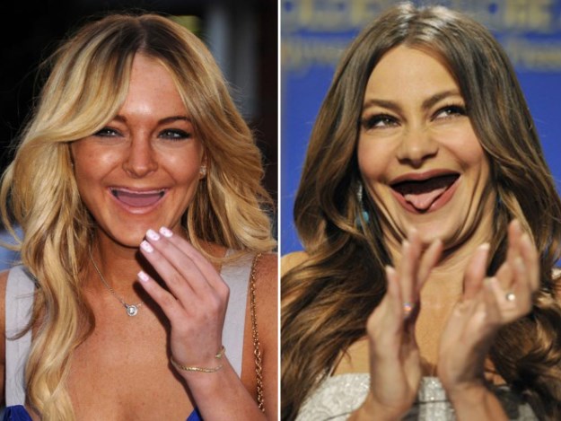 Celebs Without Teeth