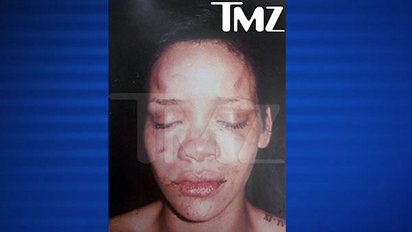 Chris Brown Beats Rihanna Police Report