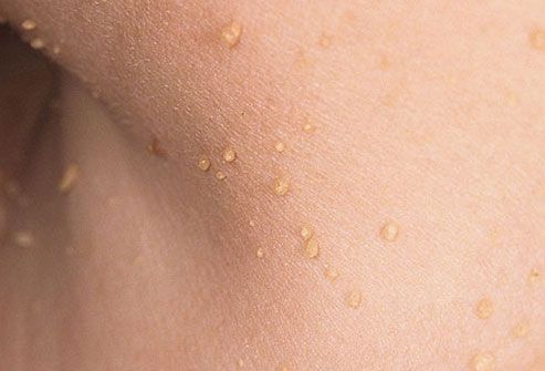 Common Skin Rashes In Adults