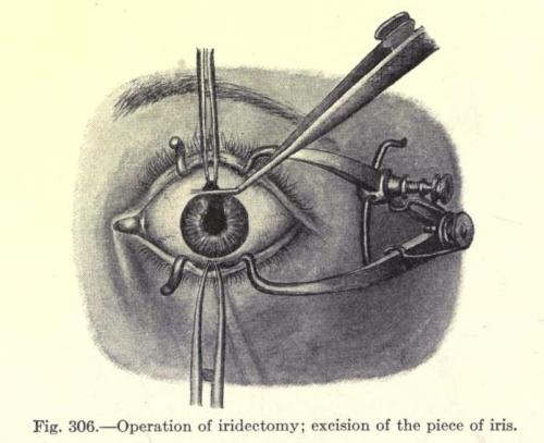 David Bowie Eyesight