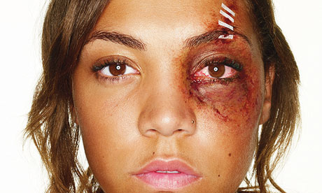 Domestic Abuse Pictures