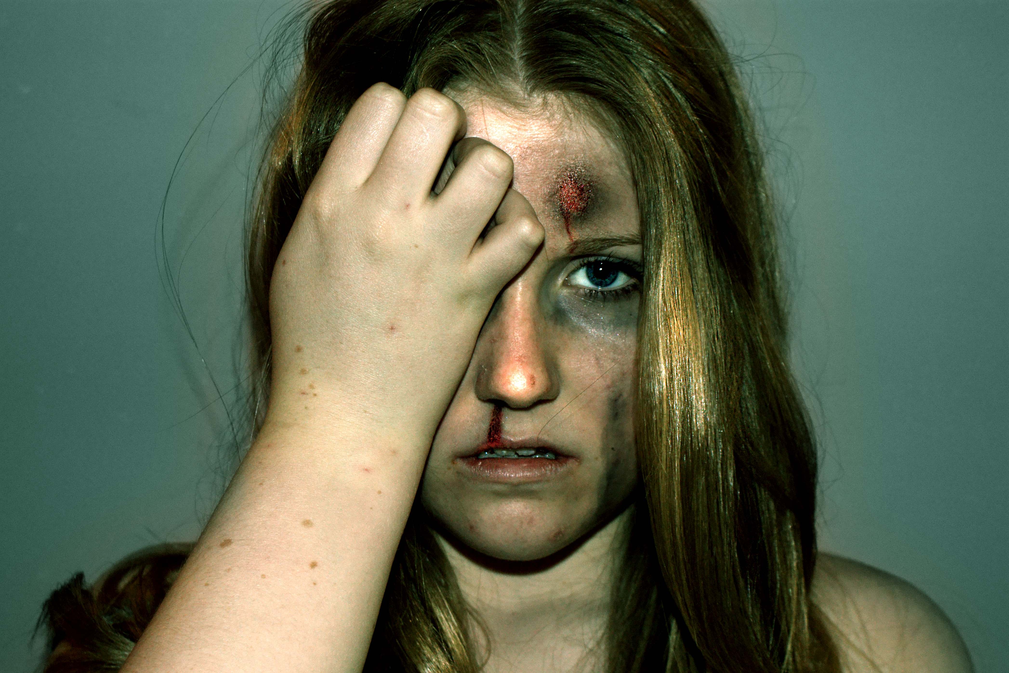 Domestic Abuse Pictures