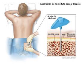 Esternon Inflamado Causas