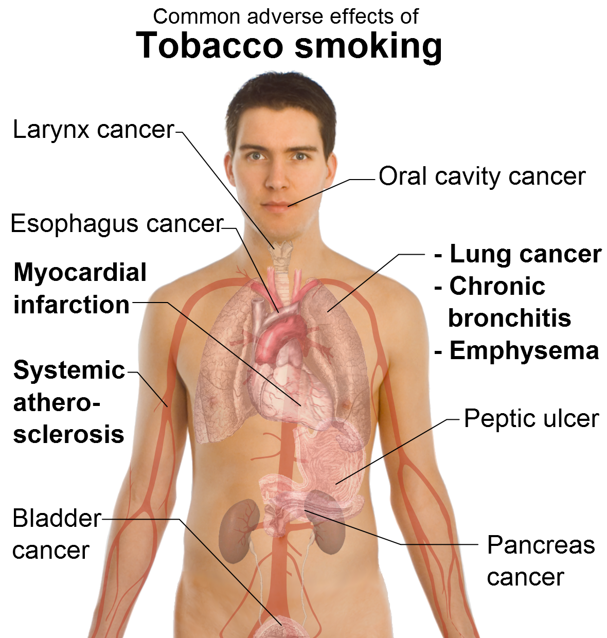 Health Benefits Of Quitting Smoking