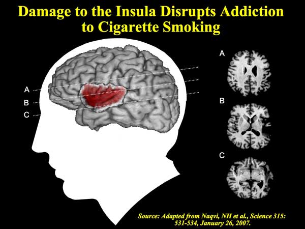 Health Benefits Of Quitting Smoking Over Time