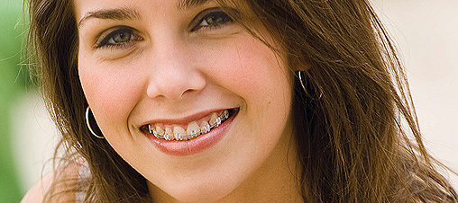 Healthy Gums With Braces