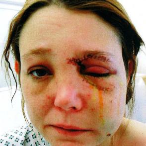 Images Of Abused Women