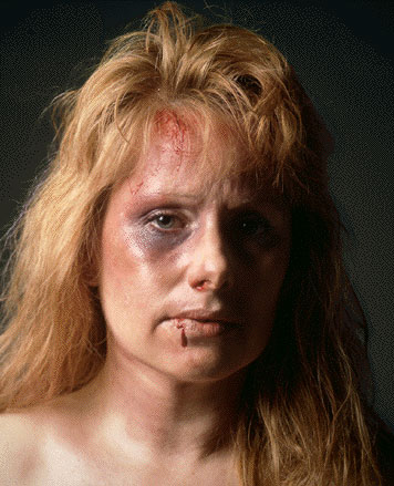 Images Of Abused Women