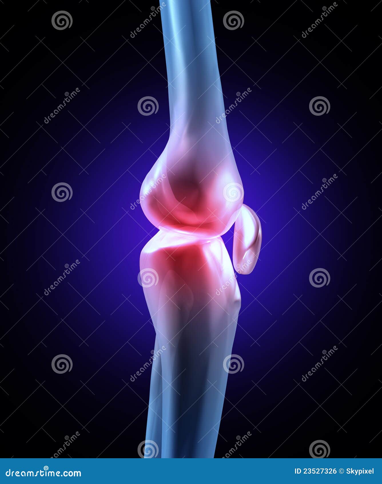 Joint Pain Images