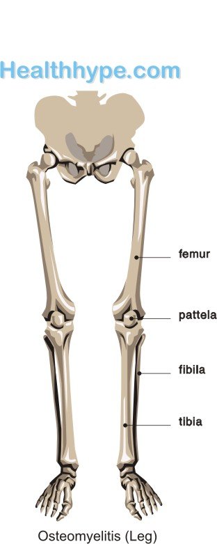 Joint Pain Leg