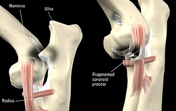 Joint Pain Leg