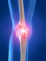 Joint Pain Treatment